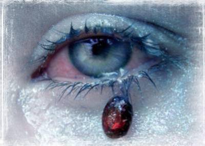 la douleur